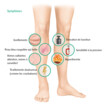 Symptômes de la thrombose veineuse profonde